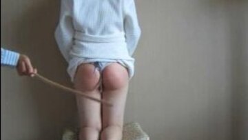 stepdaughter's little booty gets red and sore